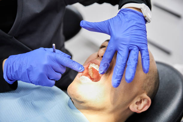 Best Chipped Tooth Repair Near Me  in Brewerton, NY